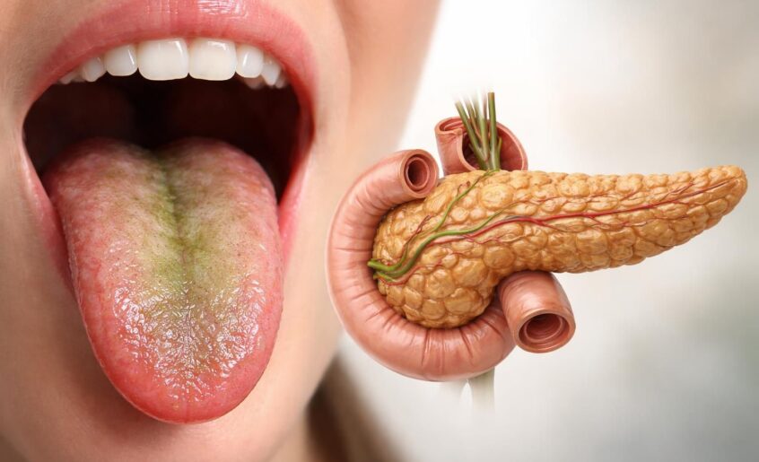 découvrez pourquoi un goût amer dans la bouche peut être lié à des problèmes du pancréas et apprenez à reconnaître ces signaux importants pour votre santé.